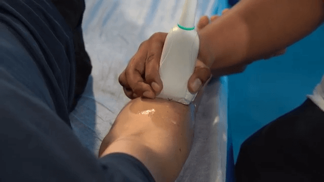 Exploración ecográfica del miembro superior: codo, antebrazo y muñeca