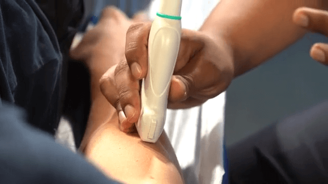 Ecografía y fisioterapia, generalidades y parámetros